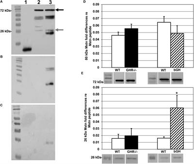 Relative Contributions of Myostatin and the GH/IGF-1 Axis in Body Composition and Muscle Strength